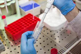 Laboratory work with plasmid DNA extraction