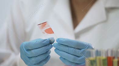 Biochemical research, female medic analyzing blood sample using microscope