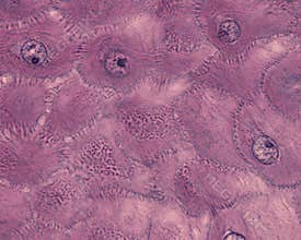 Epidermis. Spinous cell layer