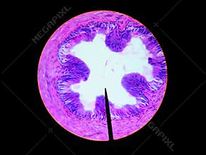 Wet mount vas ductus deferens microscopic cross section view