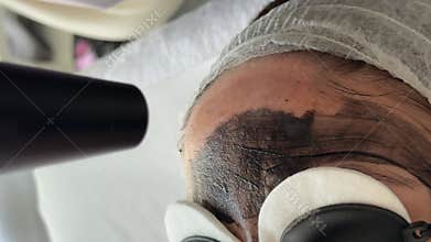 Young woman getting carbon laser facial at beauty clinic. Professional skincare