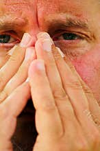 Allergies