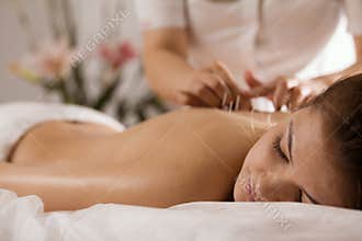 The doctor sticks needles into the girl`s body on the acupuncture - close up
