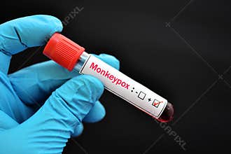 Blood sample positive with Monkeypox virus