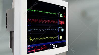 Intensive care unit ECG monitor