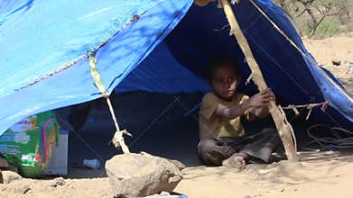 Yemeni child lives in the open because of the war