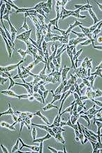 Prostate Cancer cells