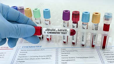Lab technician assistant or doctor holding Blood testing over requisition report for blood chemistry test