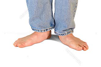 Extemely flat feet and fallen arches