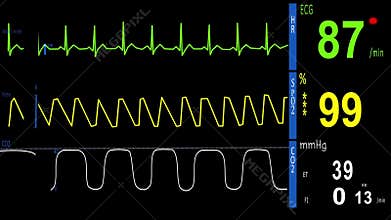 EKG, ECG, Heart Monitor