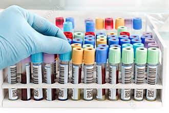 Hand doctor holding a blood tube test with bar code for analysis