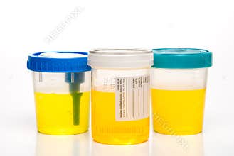 Urine Samples