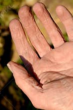Cracked skin on a workman's hand