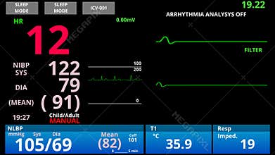 Patient returns from medical death, pulse down then up, ER vital signs monitor