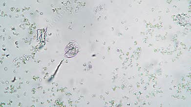 Infusoria vorticella feeds on bacteria in troubled waters