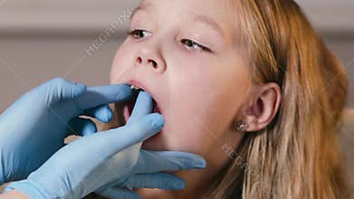 The orthodontist places a special plate on the girl's teeth to align them, correction of teeth in childhood