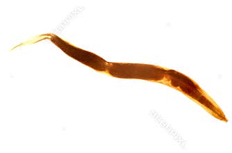 Enterobius vermicularis, isolated