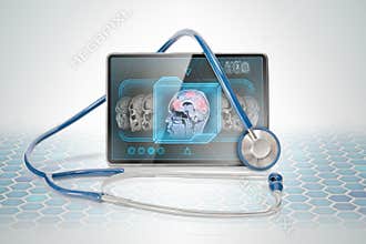 Tablet displaying brain scan