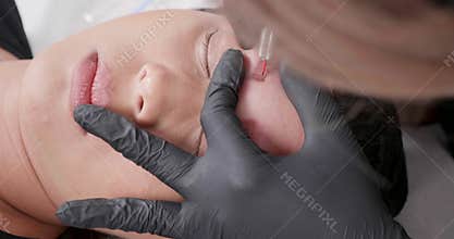 Static closeup shot of beautician hand in black gloves performing tattoo removal