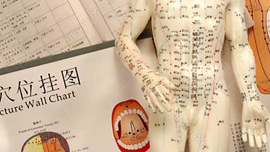 Acupuncture - Chinese Medicine - HD