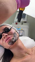 Young woman getting carbon laser facial at beauty clinic. Professional skincare