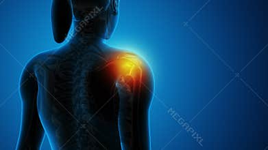 Female having pain in shoulder