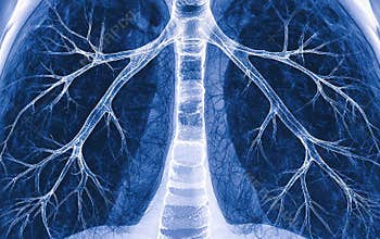 Detailed illustration of human lungs with bronchial tree displaying intricate network of airways in a cool blue