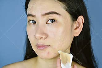 Cosmetic makeup remover, Asian woman cleaning face with cotton pad.