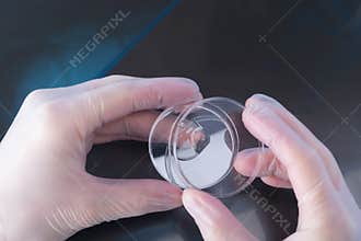 Against the background of an x-ray of a man, the scientist`s hands are holding a petri dish with biomaterials
