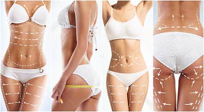Collage of a female body with arrows.