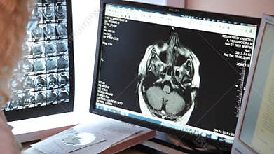 Computed tomography lab. Scan medical test /examination in a modern hospital. MRI machine and screens with doctor.