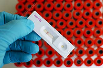 Hepatitis B antibody negative