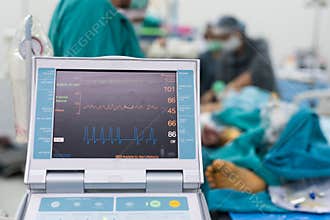 Intraaortic balloon pump