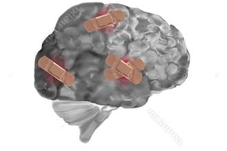 Bandages On Damaged Brain