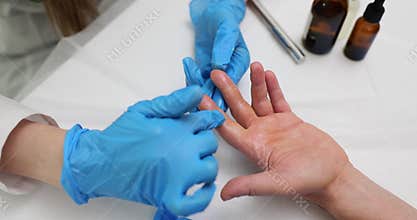 Doctor applies healing ointment to treat patient hand