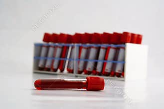 Test tubes with blood