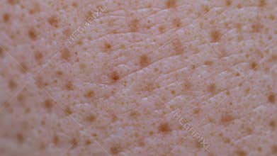 Extreme close-up macro shot of human skin texture, showing detailed pores, some clogged with blackheads, and fine lines. This