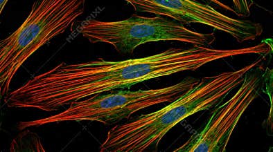 Vascular Smooth Muscle Cell Calponin Stress Fiber Alignment