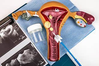 Gynecological cytology concept with cervical sample collection and uterus model