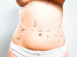 Breast, abdominal surgeries