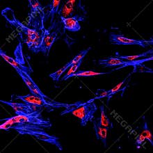Immunofluorescence confocal imaging of a melanoma cancer cell line
