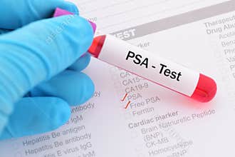 PSA test