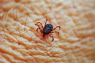 Tick on skin
