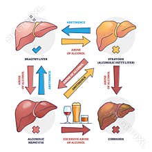 Alcoholic liver disease from excessive abuse of alcohol outline concept