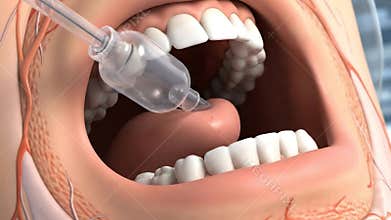 Detailed View of Oral Anesthesia Procedure on Tongue with Dental Anatomy White Teeth and Anatomical Representation of Nerves in