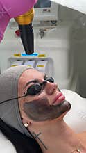 Young woman getting carbon laser facial at beauty clinic. Professional skincare
