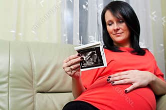 Pregnant woman ultrasound print