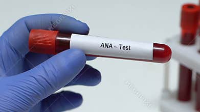 ANA-Test, doctor holding blood sample in tube close-up, health examination