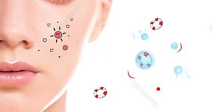 Teenage acne. Close-up of a woman`s face, animated cartoon pimples
