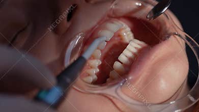 Examination of the teeth